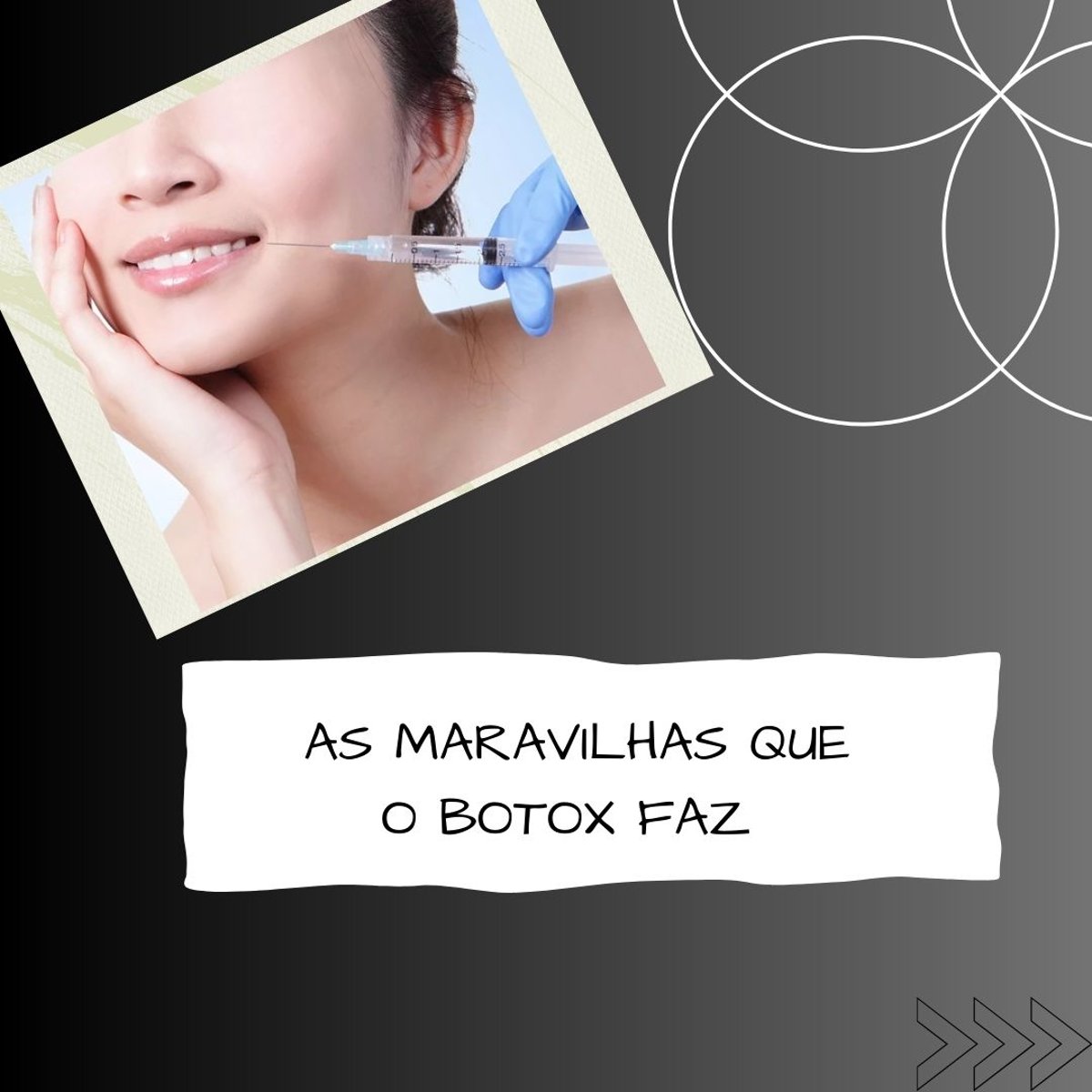 Imagem da publicação original: As maravilhas da toxina botulínica