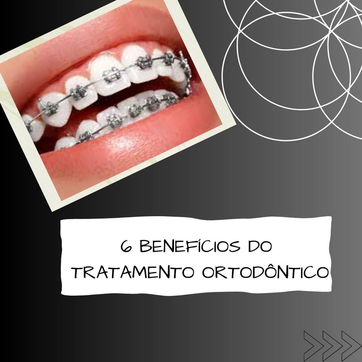 Imagem da publicação original: 6 benefícios do tratamento ortodôntico